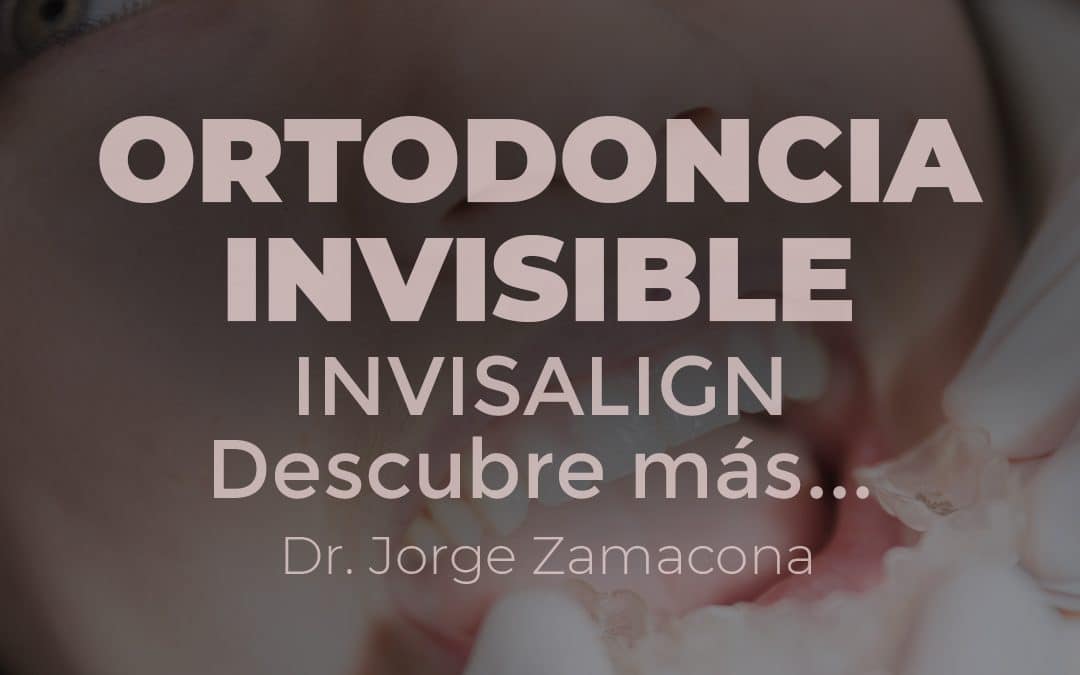 ortodoncia-invisible-invisaling