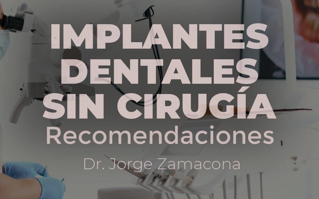 implantes-dentales-sin-cirugia
