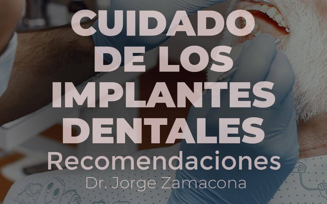 cuidado-implantes-dentales