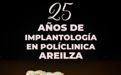 25 AÑOS DE IMPLANTOLOGIA EN POLICLINCA  AREILZA