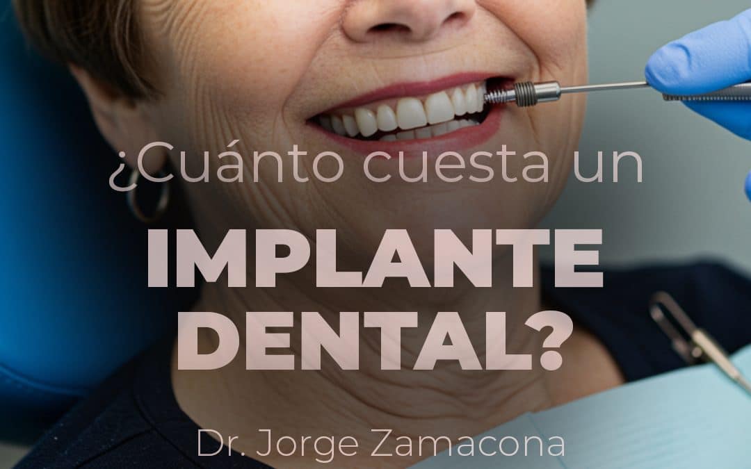¿Cuánto cuesta un implante dental?