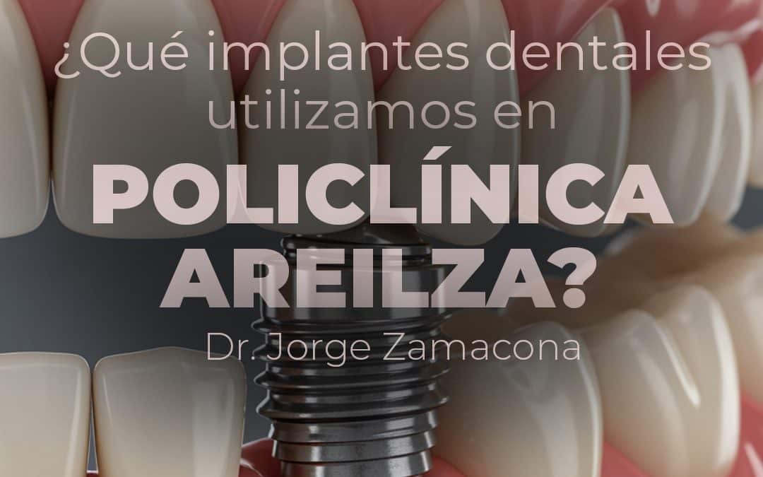 implantes dentales